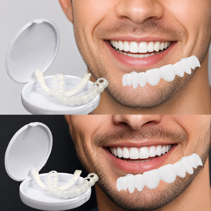Carillas dentales